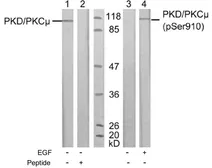 Anti-PKC mu (phospho Ser910) antibody used in Western Blot (WB). GTX78965
