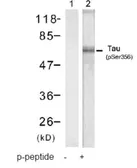 Anti-PKC mu (phospho Ser738) antibody used in Western Blot (WB). GTX78966