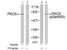 Anti-PKC delta (phospho Ser645) antibody used in Western Blot (WB). GTX78968