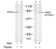 Anti-PKC beta 2 (phospho Thr641) antibody used in Western Blot (WB). GTX78969