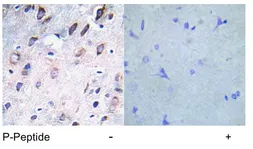 Anti-PDGF Receptor beta (phospho Tyr751) antibody used in IHC (Paraffin sections) (IHC-P). GTX78970