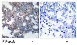 Anti-p70 S6K (phospho Ser424) antibody used in IHC (Paraffin sections) (IHC-P). GTX78978