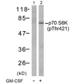 Anti-p70 S6K (phospho Thr421) antibody used in Western Blot (WB). GTX78979