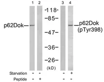 Anti-p62Dok (phospho Tyr398) antibody used in Western Blot (WB). GTX78980