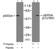Anti-p62Dok (phospho Tyr362) antibody used in Western Blot (WB). GTX78981