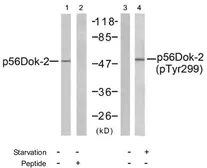 Anti-DOK2 (phospho Tyr299) antibody used in Western Blot (WB). GTX78982