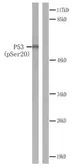Anti-p53 (phospho Ser20) antibody used in Western Blot (WB). GTX78985