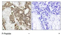 Anti-ERK1 (phospho Tyr204) + ERK2 (phospho Tyr187) antibody used in IHC (Paraffin sections) (IHC-P). GTX78987