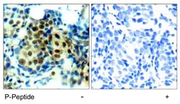 Anti-ERK1 (phospho Thr202) + ERK2 (phospho Thr185) antibody used in IHC (Paraffin sections) (IHC-P). GTX78988