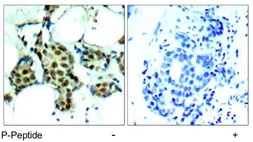 Anti-p38 MAPK (phospho Tyr182) antibody used in IHC (Paraffin sections) (IHC-P). GTX78989