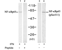Anti-NFkB p65 (phospho Ser311) antibody used in Western Blot (WB). GTX78995