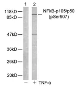 Anti-NFkB p105 (phospho Ser907) antibody used in Western Blot (WB). GTX78998