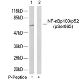 Anti-NFkB p100 (phospho Ser865) antibody used in Western Blot (WB). GTX79000