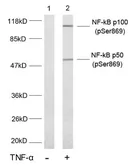 Anti-NFkB p100 (phospho Ser869) antibody used in Western Blot (WB). GTX79001
