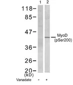 Anti-MyoD1 (phospho Ser200) antibody used in Western Blot (WB). GTX79004