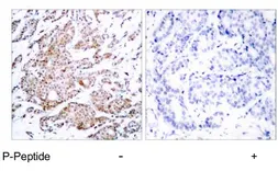 Anti-c-Myc (phospho Thr58) antibody used in IHC (Paraffin sections) (IHC-P). GTX79007