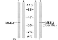 Anti-MEK3 (phospho Ser189) antibody used in Western Blot (WB). GTX79010