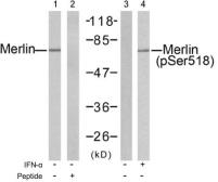 Anti-Merlin (phospho Ser518) antibody used in Western Blot (WB). GTX79013