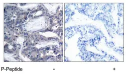 Anti-MEK2 (phospho Thr394) antibody used in IHC (Paraffin sections) (IHC-P). GTX79014