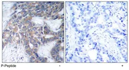 Anti-MEK1 (phospho Ser217) antibody used in IHC (Paraffin sections) (IHC-P). GTX79015