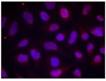 Anti-MEF2A (phospho Thr312) antibody used in Immunocytochemistry/ Immunofluorescence (ICC/IF). GTX79019