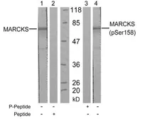 Anti-MARCKS (phospho Ser152) antibody used in Western Blot (WB). GTX79020