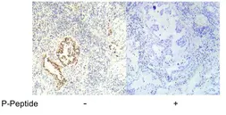 Anti-LKB1 (phospho Ser334) antibody used in IHC (Paraffin sections) (IHC-P). GTX79021