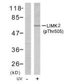 Anti-LIM kinase 2 (phospho Thr505) antibody used in Western Blot (WB). GTX79022