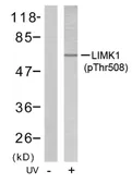 Anti-LIMK1 (phospho Thr508) + LIMK2 (phospho Thr505) antibody used in Western Blot (WB). GTX79023