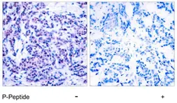 Anti-JunD (phospho Ser255) antibody used in IHC (Paraffin sections) (IHC-P). GTX79026
