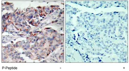 Anti-JAK2 (phospho Tyr221) antibody used in IHC (Paraffin sections) (IHC-P). GTX79031