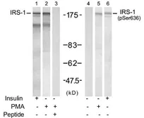 Anti-IRS1 (phospho Ser636) antibody used in Western Blot (WB). GTX79037