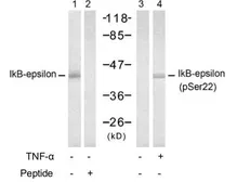 Anti-IKB epsilon (phospho Ser22) antibody used in Western Blot (WB). GTX79041