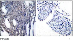 Anti-IKB alpha (phospho Tyr42) antibody used in IHC (Paraffin sections) (IHC-P). GTX79043