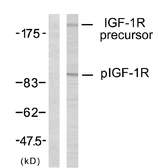 Anti-IGF1R (phospho Tyr1131) / Insulin Receptor (phospho Tyr1146) antibody used in Western Blot (WB). GTX79046