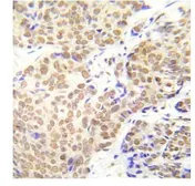 Anti-HDAC1 (phospho Ser421/Ser423) antibody used in IHC (Paraffin sections) (IHC-P). GTX79062