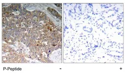 Anti-GSK3 alpha (phospho Tyr279) + GSK3 beta (phospho Tyr216) antibody used in IHC (Paraffin sections) (IHC-P). GTX79063