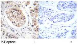 Anti-FOXO3A (phospho Ser253) antibody used in IHC (Paraffin sections) (IHC-P). GTX79072