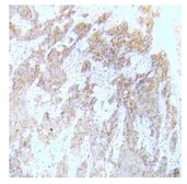 Anti-FLT3 (phospho Tyr591) antibody used in IHC (Paraffin sections) (IHC-P). GTX79073