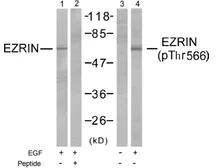 Anti-Ezrin (phospho Thr567) antibody used in Western Blot (WB). GTX79080