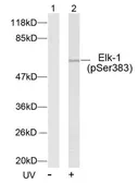 Anti-ELK1 (phospho Ser383) antibody used in Western Blot (WB). GTX79084