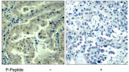 Anti-EIF4G (phospho Ser1231) antibody used in IHC (Paraffin sections) (IHC-P). GTX79087