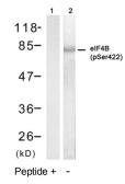 Anti-eIF4B (phospho Ser422) antibody used in Western Blot (WB). GTX79088