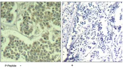 Anti-eIF2 alpha (phospho Ser48) antibody used in IHC (Paraffin sections) (IHC-P). GTX79089