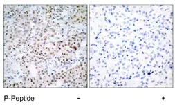 Anti-CREB (phospho Ser133) antibody used in IHC (Paraffin sections) (IHC-P). GTX79100