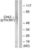 Anti-Chk2 (phospho Thr387) antibody used in Western Blot (WB). GTX79109