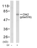 Anti-Chk2 (phospho Ser516) antibody used in Western Blot (WB). GTX79110