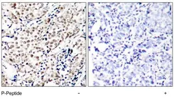 Anti-Chk1 (phospho Ser345) antibody used in IHC (Paraffin sections) (IHC-P). GTX79111