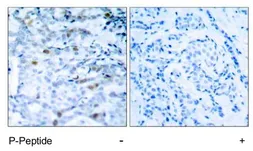Anti-CDC2 (phospho Thr161) antibody used in IHC (Paraffin sections) (IHC-P). GTX79115