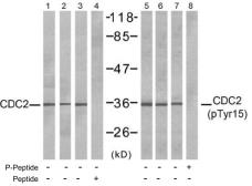 Anti-CDC2 (phospho Tyr15) antibody used in Western Blot (WB). GTX79116